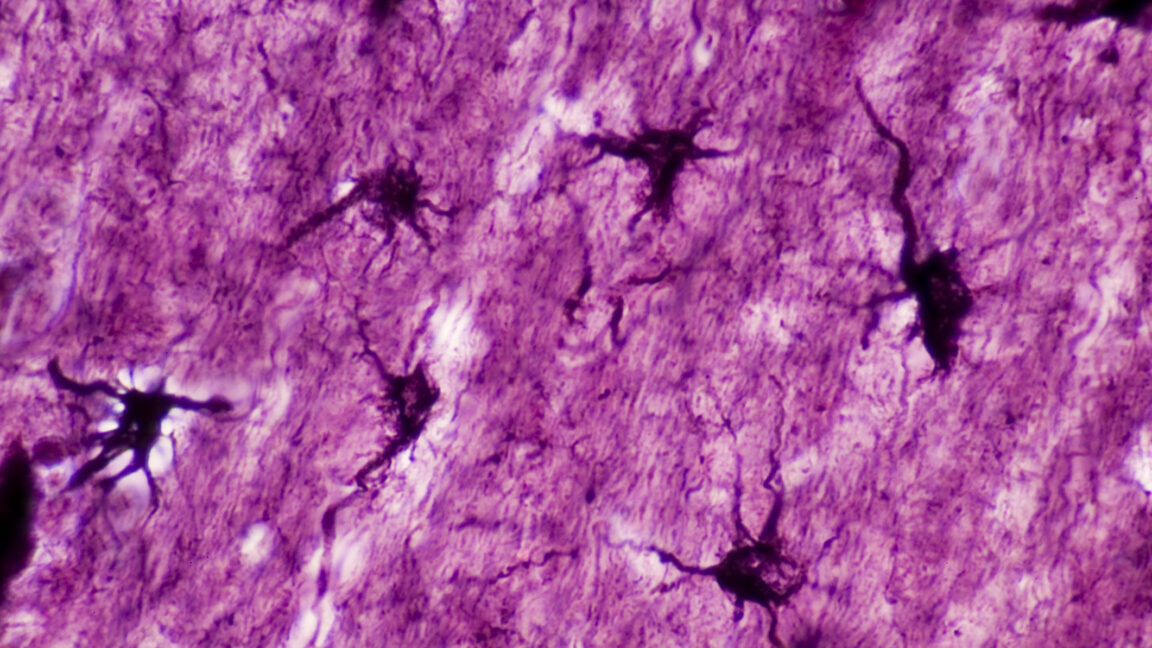 Astrocytes play a key role in memory